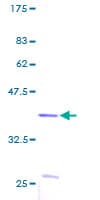 Human S100A2 Protein (Recombinant GST)