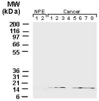 BIRC5 / Survivin Antibody