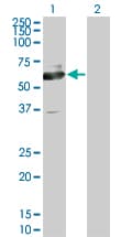 ACCS / ACS Antibody (clone 1D2)