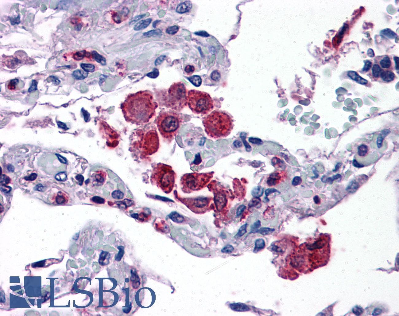 IHC-plus™ ALOX5AP / FLAP Antibody (aa148-161)
