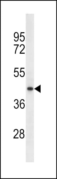 Monoclonal Mouse anti-Human TECRL Antibody (aa325-354, WB)