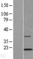 TMCO2 Protein (Over-Expression Lysate Myc-DDK (Flag))