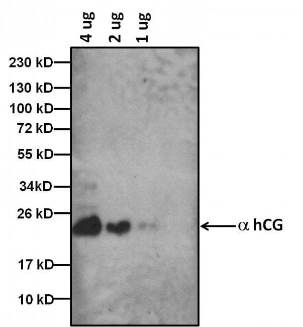 hCG / Chorionic Gonadotropin Antibody (clone 34P2C2)
