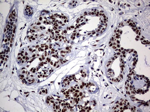 HNRPM / HNRNPM Antibody (aa1-261, clone OTI6H7)