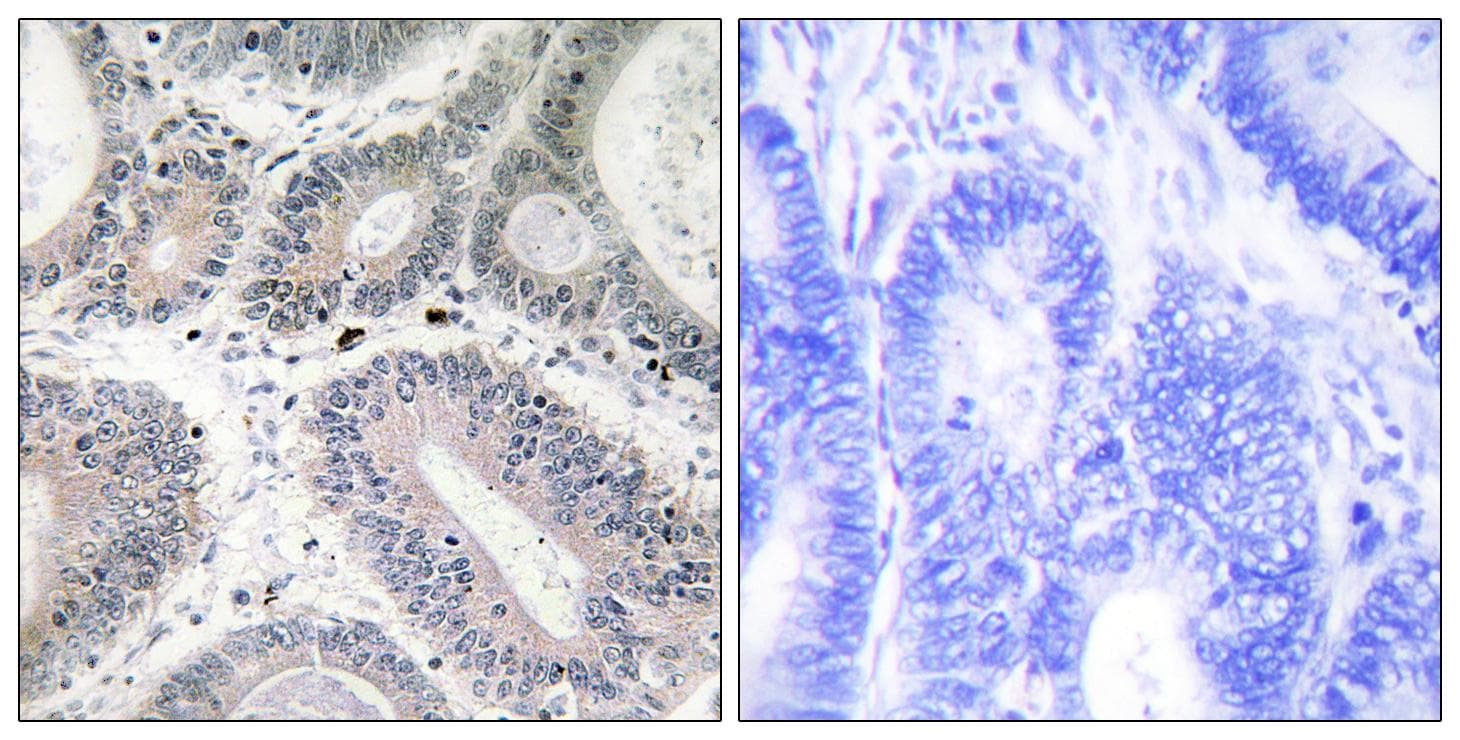 Polyclonal Rabbit anti-Human LAMA3 / Laminin Alpha 3 Antibody (IHC, IF)