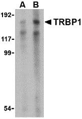 IHC-plus™ TRM3 / TARBP1 Antibody