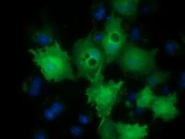 LIN7B Antibody (clone OTI1C9)