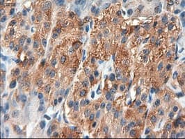 PTCH1 / Patched 1 Antibody (clone OTI5C7)