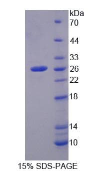 Mouse MCCC2 / MCCB Protein (Recombinant)