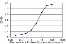 TPI1 / TPI Antibody (clone 1D10-2E2)
