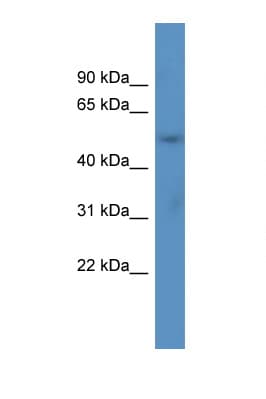 ACOT9 Antibody (aa23-72)