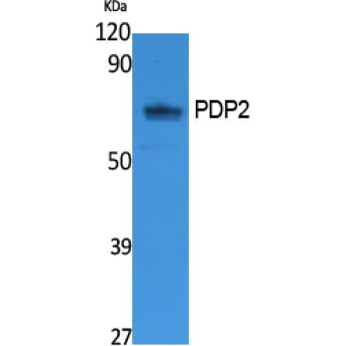 Polyclonal Rabbit anti-Human PDP2 Antibody (70-150 aa, Internal, WB)
