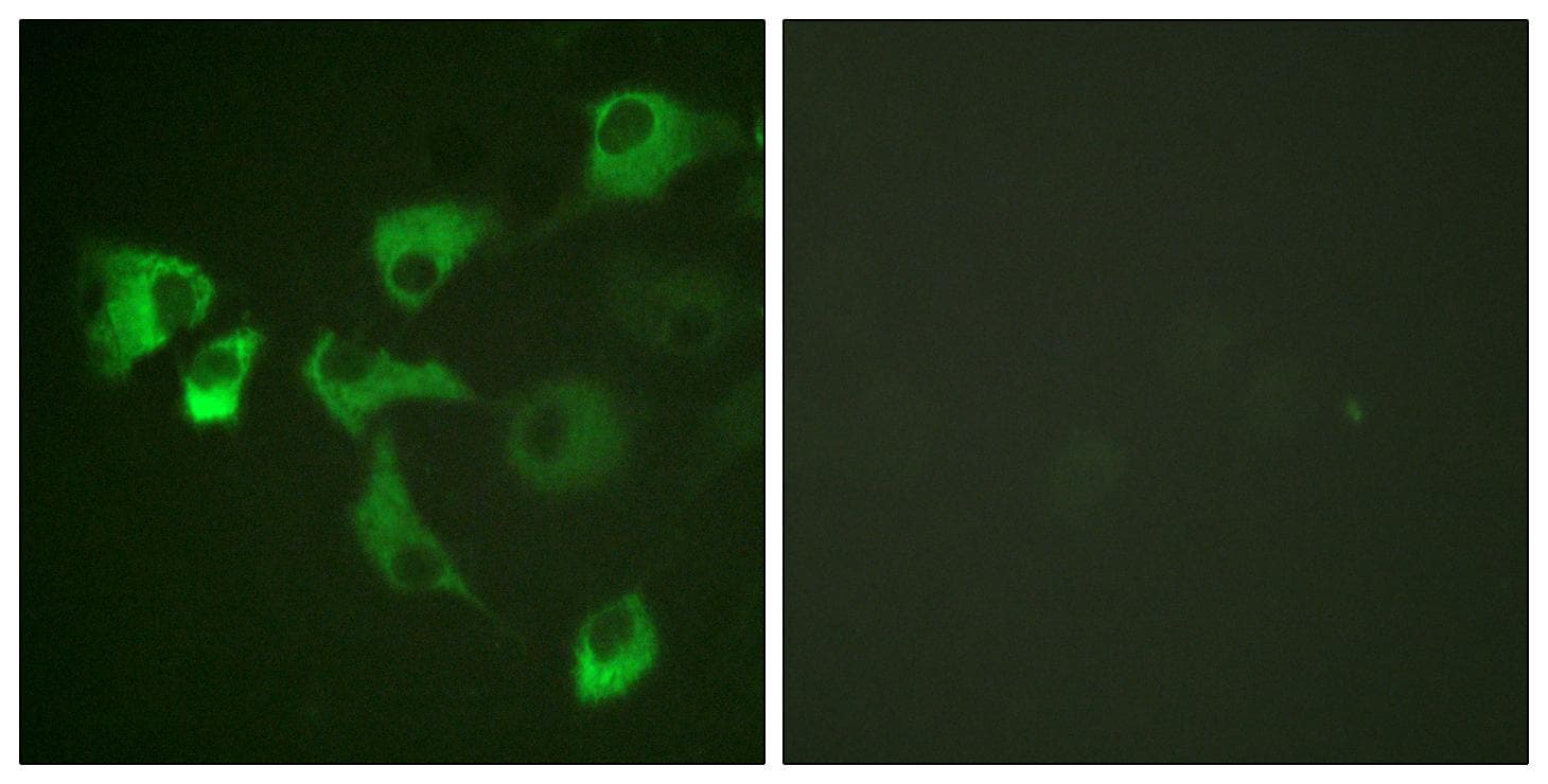 EEF2 / Elongation Factor 2 Antibody (phospho-Thr56)