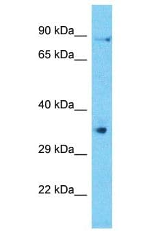 Polyclonal Rabbit anti-Human C6orf58 Antibody (aa86-135, WB)
