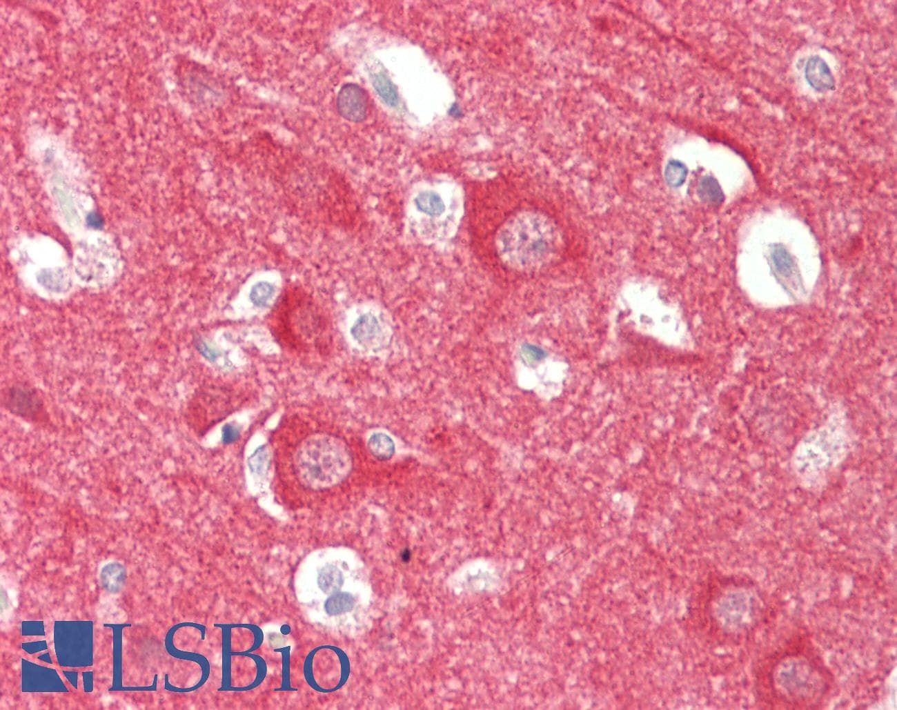 IHC-plus™ NCS1 / Neuronal Calcium Sensor Antibody (C-Terminus)