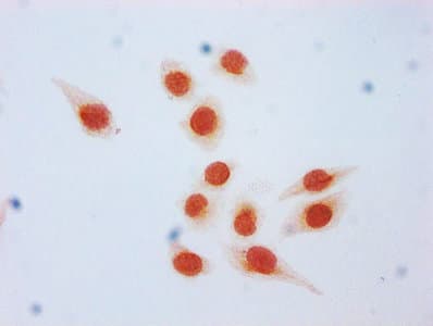Polyclonal Rabbit anti-Human HIST1H3A Antibody (IHC, WB)