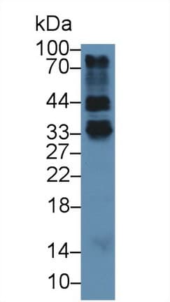 FR4 / Folate Receptor 4 Antibody (aa56-234)