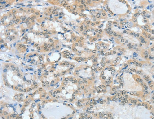ASH2L / ASH2 Antibody