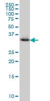 IHC-plus™ CRYM Antibody (clone 6B3)