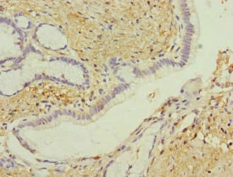 GIPR / GIP Receptor Antibody