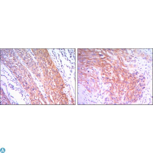 HK2 / Hexokinase 2 Antibody