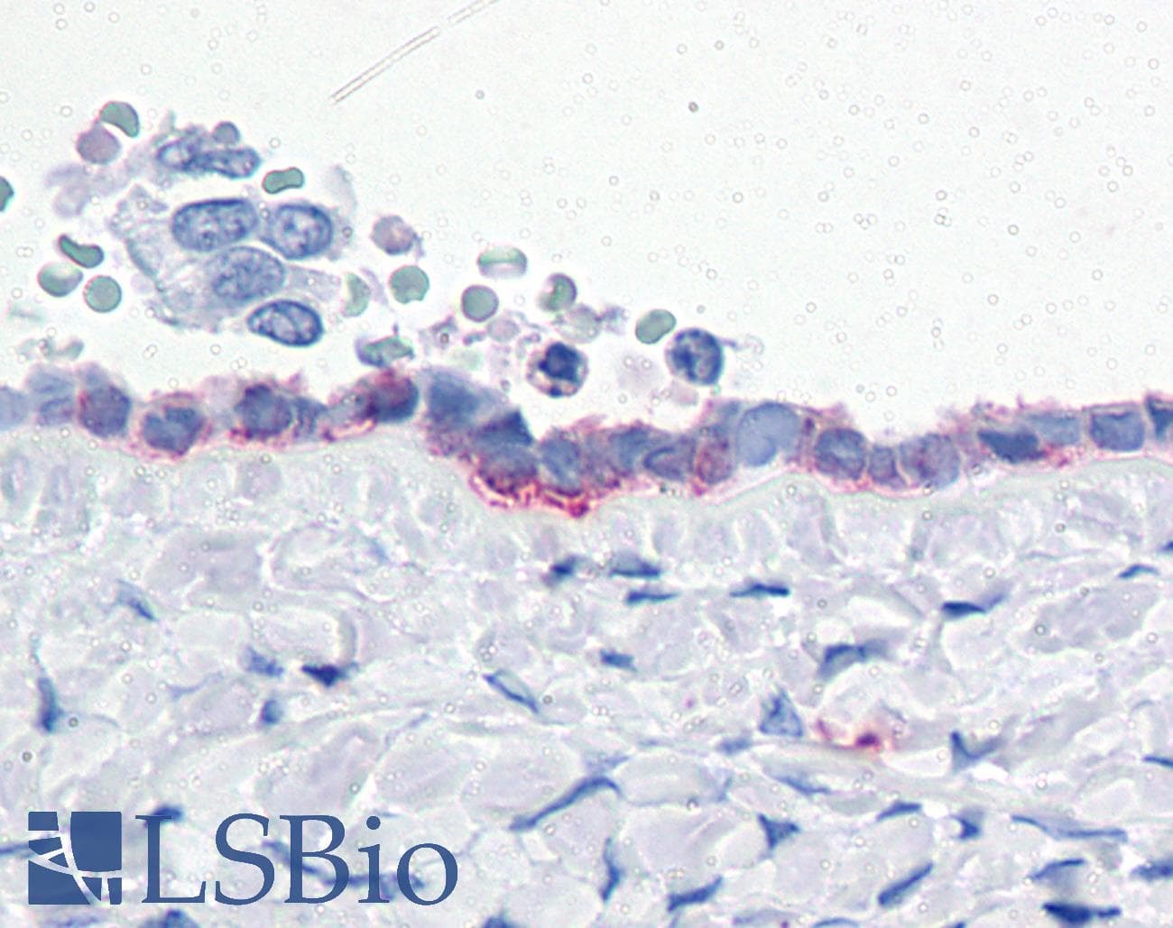 IHC-plus™ Polyclonal Rabbit anti-Human ENPP3 / CD203c Antibody (Internal, IHC)