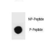 Polyclonal Rabbit anti-Mouse Tuberin / TSC2 Antibody (phospho-Ser1343)
