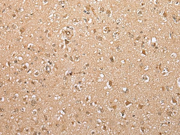 Polyclonal Rabbit anti-Human ATXN7L3 Antibody (IHC, WB)