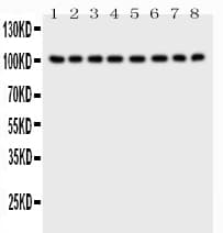 MME / CD10 Antibody (aa52-750)