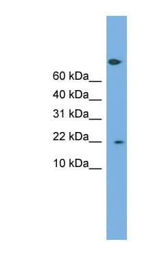 Polyclonal Rabbit anti-Human PTGES3 / p23 Antibody (aa35-84, WB)