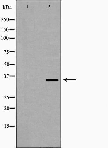PP2CB / PPP2CB Antibody