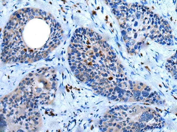 CCN5 Antibody