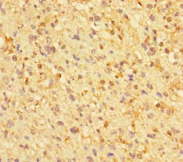 Polyclonal Rabbit anti-Human ZNF384 Antibody (IHC, WB)