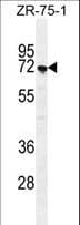 SUSD5 Antibody (aa593-621)