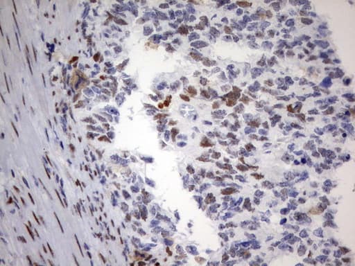 PARN Antibody (aa1-266, clone UMAB143)