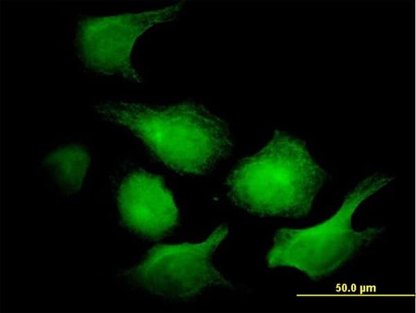 AK1 / Adenylate Kinase 1 Antibody (clone 3G8-1B11)