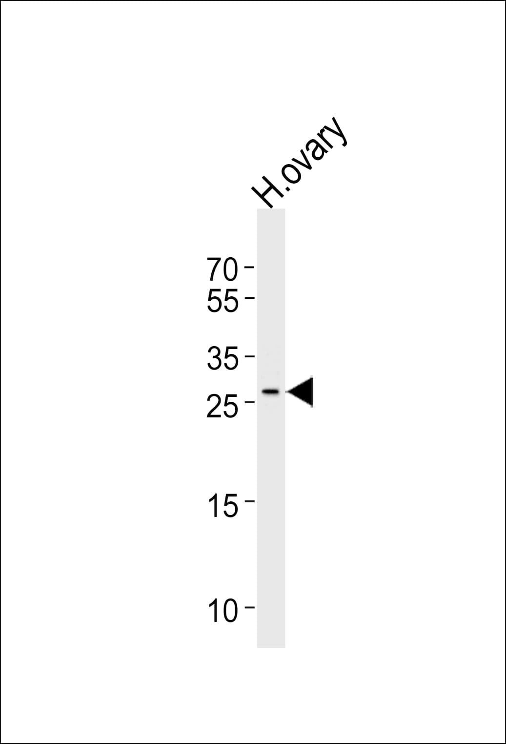 LRRN4CL Antibody (aa117-146)