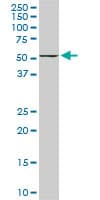 FKBP4 / FKBP52 Antibody (clone 5C11)