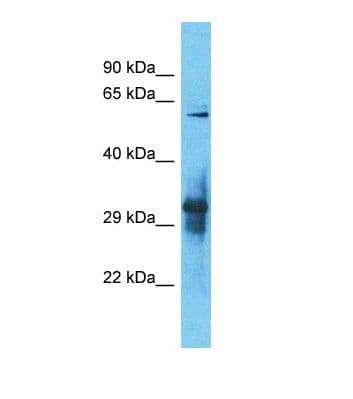 IGLON5 Antibody (aa233-282)