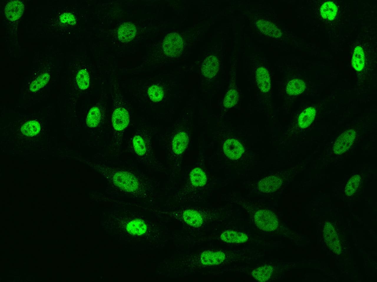 HIF1A / HIF1 Alpha Antibody