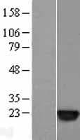 Human SAT1 / SAT Protein (Over-Expression Lysate Myc-DDK (Flag))