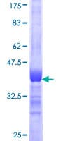 Human CHD1 Protein (Recombinant GST, N-terminus)