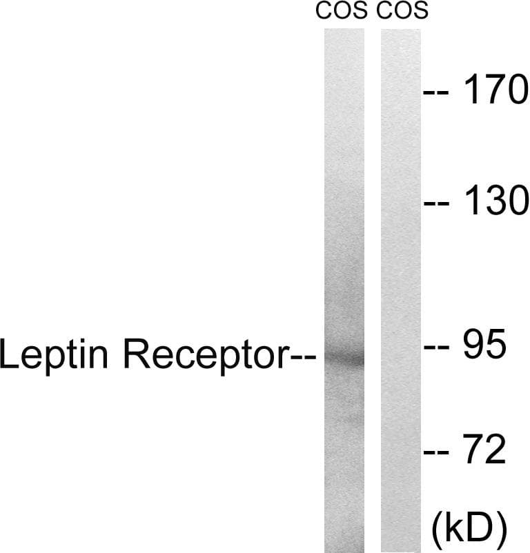 LEPR / Leptin Receptor Antibody (p1141)