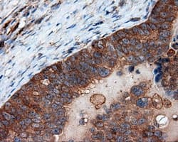 PIM2 / Pim-2 Antibody (clone OTI8G10)