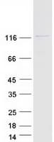 Human RANBP6 Protein (Recombinant Myc-DDK (Flag))
