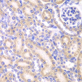 Polyclonal Rabbit anti-Human AK4 / Adenylate Kinase 4 Antibody (IHC, IF, WB)