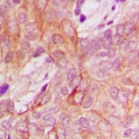 PPM1K Antibody (Internal)