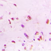 XRCC6 / Ku70 Antibody (C-Terminus)