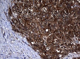 NME1 / NM23 Antibody (clone OTI6A11)