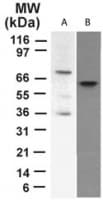 IHC-plus™ TP73 / p73 Antibody (N-Terminus, clone 5B429)